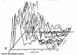 Fig. 9. EEG display of psychic.