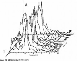 Fig. 10. EEG display of millionaire.