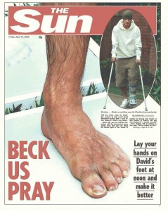 Beckhams Foot.